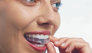 Invisalign